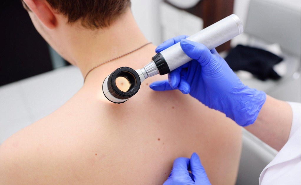 Diagnostika v dermatovenerologii v Evrodone